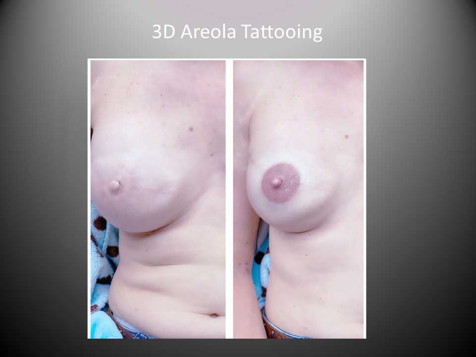 3d areola tattooing