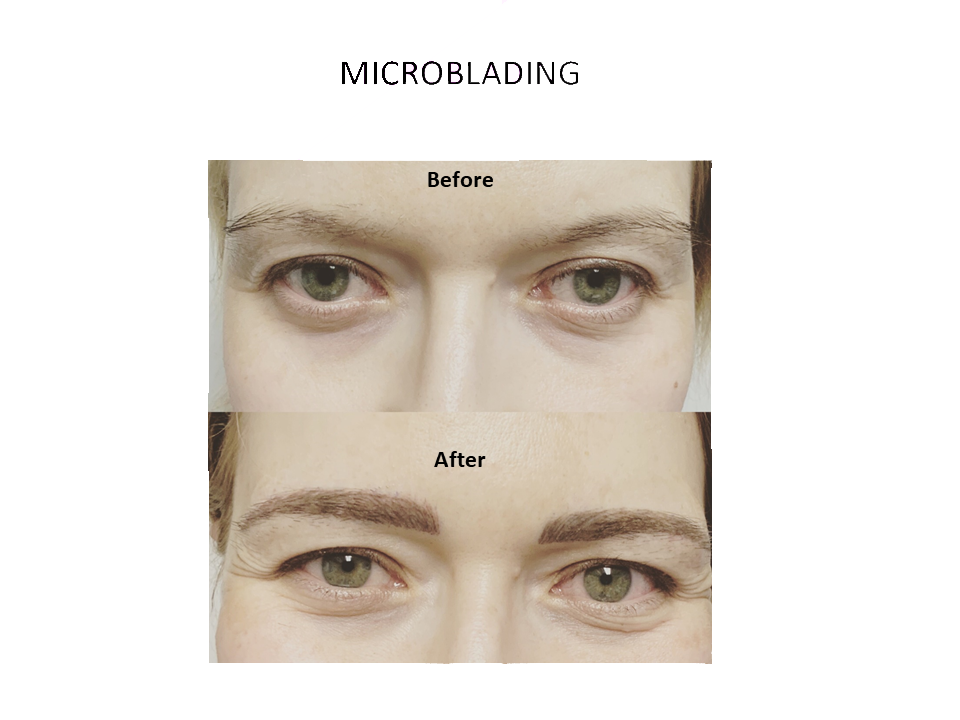 microblading